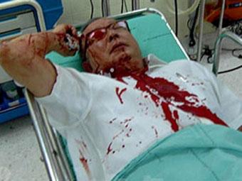 Лидера тайских манифестантов тяжело ранили в голову